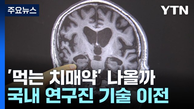 주사 대신 먹는 치매약 나올까...5천억 원 규모 기술수출 계약 / YTN