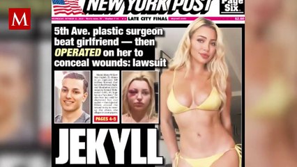 Modelo golpeada y convertida en esclava por Cirujano, revela detalles escalofriantes