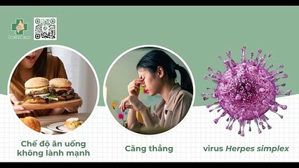 Cách trị mụn ở mép môi đơn giản và hiệu quả