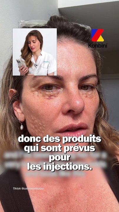 Dermato Drey, dermatologue, revient sur cette nouvelle tendance farfelue : se mettre du sperme de saumon sur le visage.