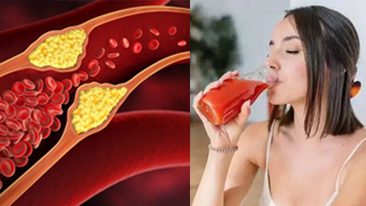 Tomato Juice Benefits In High Cholestrol: High Cholestrol Hone Par Kya Khana Chahiye Or Kya Nhi