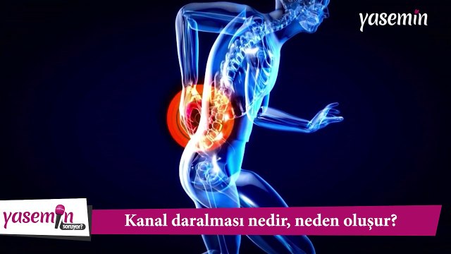 Bel fıtığı ile karıştırılıyor! Kanal daralması nedir, neden oluşur? Kanal daralması ve bel fıtığı arasındaki fark nedir?