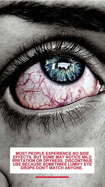 Are there any side effects to using Lumify eye drops