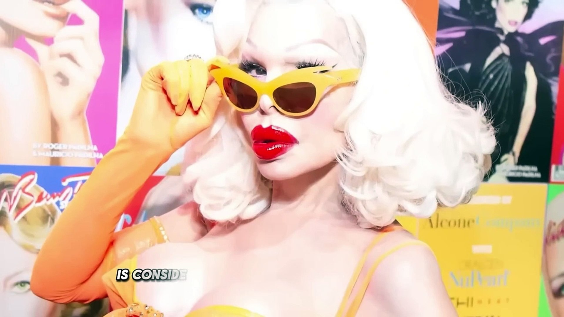 Celebrity Plastic Surgery Disasters 2/6
