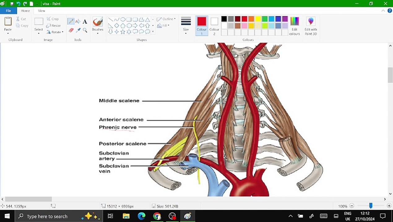 interscalene nerve block complication