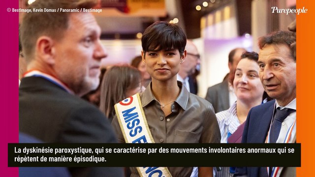 Eve Gilles (Miss France 2024) atteinte d'une pathologie très rare et en pleine crise devant une superstar, elle raconte
