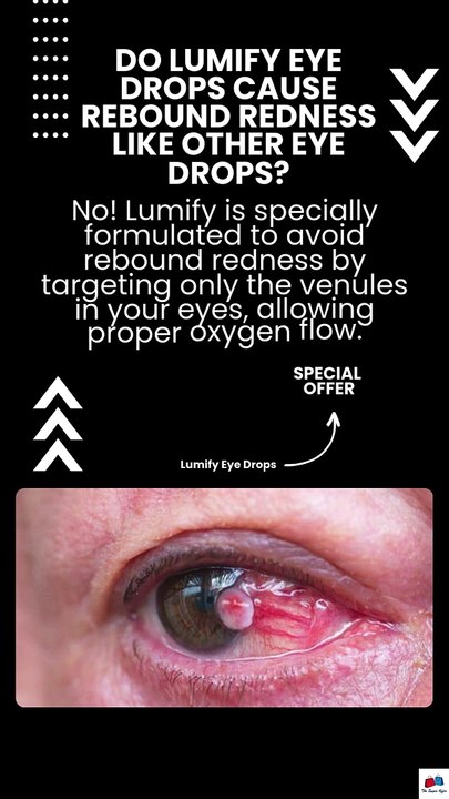 Do Lumify eye drops cause rebound redness like other eye drops