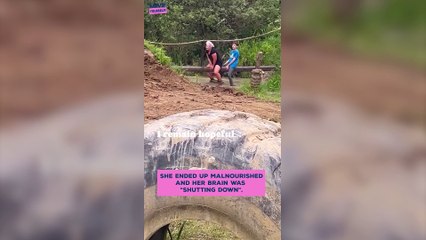 "I feel like a new woman after stoma surgery - the most confident I've ever been"