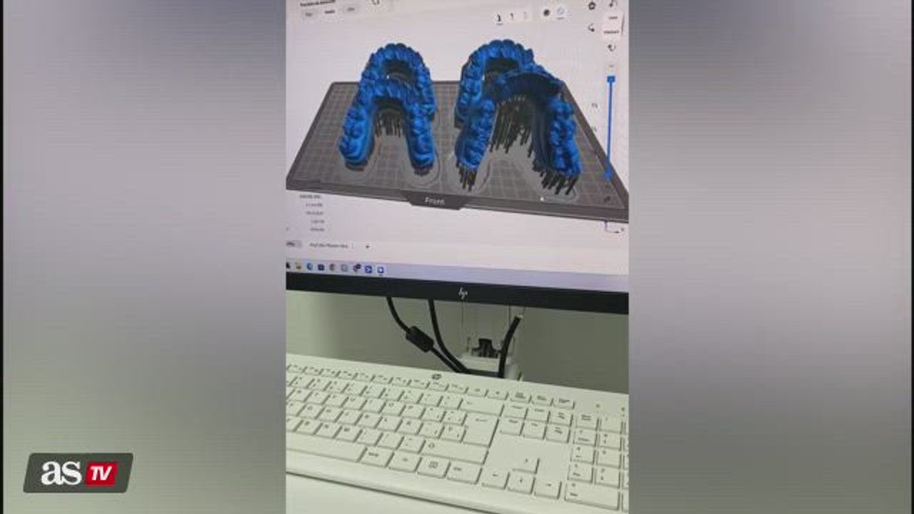 Watch: inside the creation of Lamine Yamal's special brackets for El Clásico