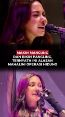 Makin Mancung dan Bikin Pangling, Ternyata Ini Alasan Mahalini Operasi Hidung