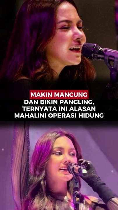 Makin Mancung dan Bikin Pangling, Ternyata Ini Alasan Mahalini Operasi Hidung
