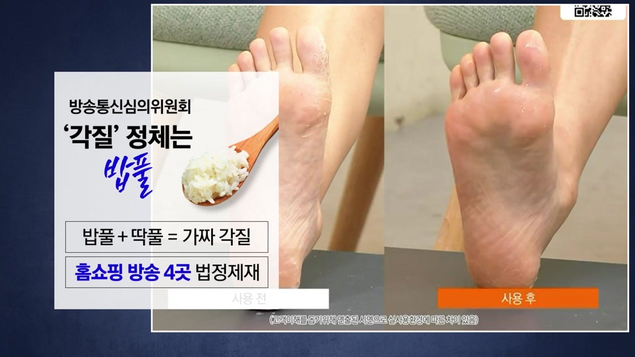 "방송 위해 일주일 모았어요"...홈쇼핑 속 '각질' 알고 보니 '밥풀' [앵커리포트...