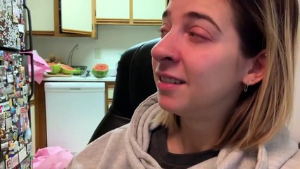 WTF Is Happening To My Eye!