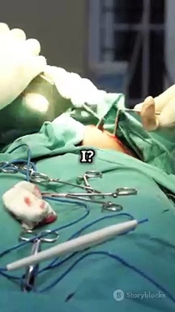 Shocking Facts About Plastic Surgery-dailymotion