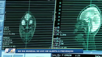 No Dia Mundial do AVC, um alerta à prevenção