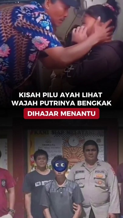 Kisah Pilu Ayah Lihat Wajah Putrinya Bengkak Dihajar Menantu