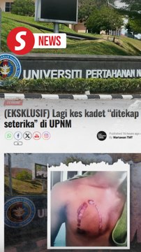 MAF probing bullying incident using hot iron at UPNM