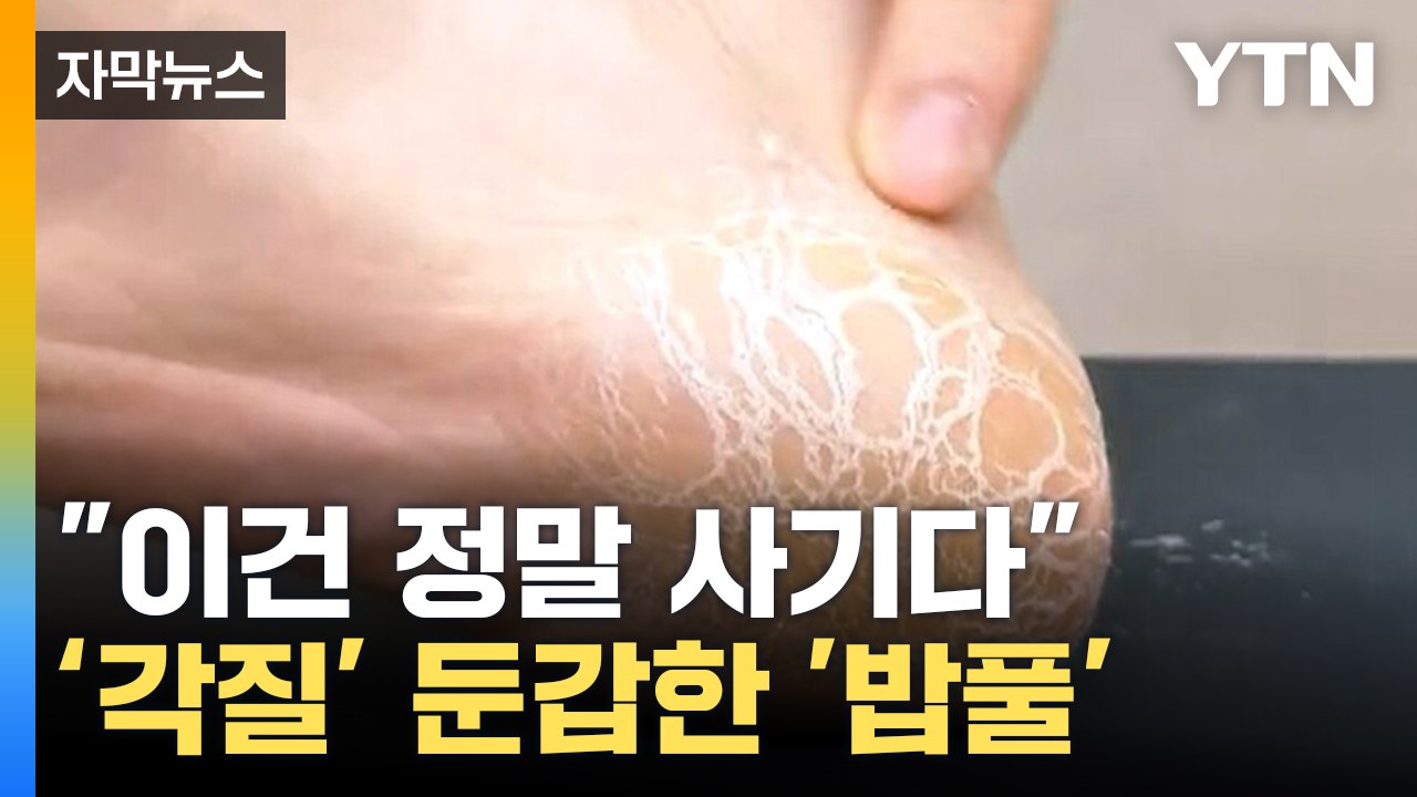 [자막뉴스] 너도나도 '가짜 각질'...홈쇼핑 업체 4곳 법정제재 / YTN