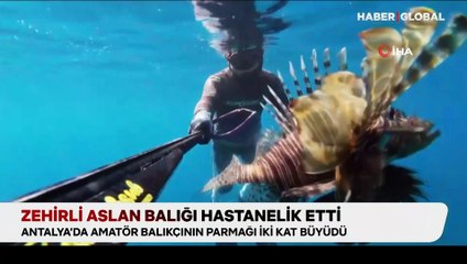 Zehirli aslan balığı hastanelik etti: Amatör balıkçının parmağı iki kat büyüdü