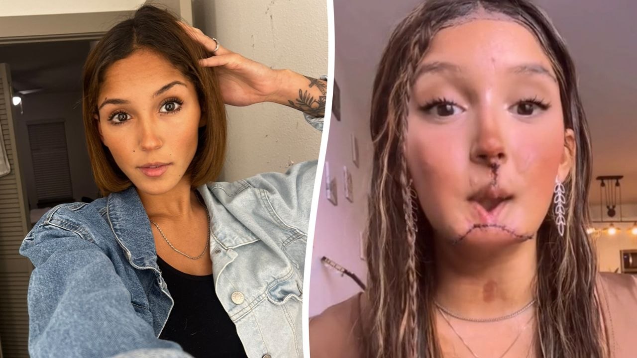 Selbstmordversuch-Überlebende wird zur stimme für psychische erkrankungen