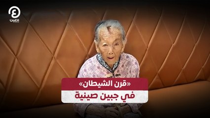 مريضة صينية تنمو