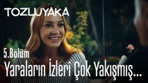 Yaraların izleri çok yakışmış... - Tozluyaka 5. Bölüm