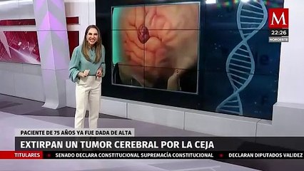 Extirpan con éxito un tumor cerebral por la ceja
