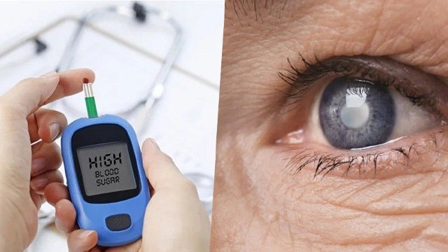 Diabetes In Eyes Symptoms: Sugar Se Ankhon Par Kya Asar Padta Hai | Diabetic Retinopathy Symptoms...