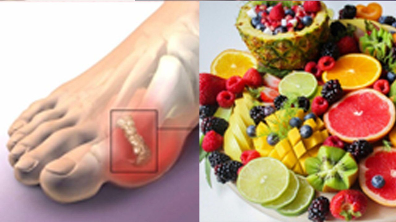 High Uric Acid Me Konsa Fal Khana Chahiye Can We Eat Vitamin C Fruits