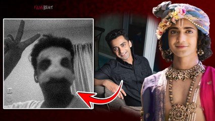 Radha Krishna के Krishna aka Sumedh Mudgalkar के साथ सेट पर हुआ हादसा,दी Health update