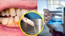 Dant Me Dard Me Namak Pani Peene Se Kya Hota Hai,Salt Water For Teeth Pain | Boldsky