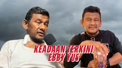 Dialisis 3 kali sehari, Ebby Yus perlu pemindahan buah pinggang