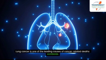 Lung Cancer Diagnostics Market