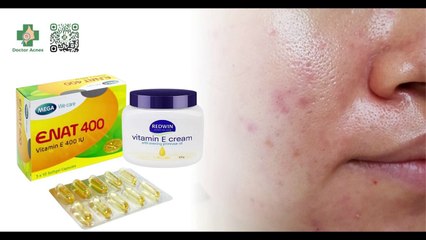 Uống vitamin E trị mụn nội tiết có thực sự hiệu quả?