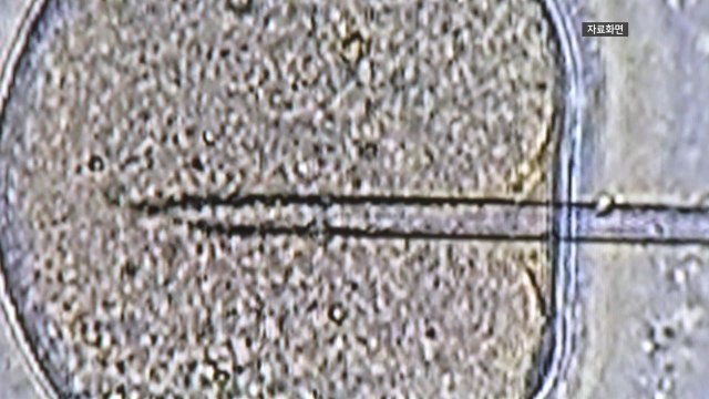 [경기] 경기도, 난임부부 시술비 지원 '출생아당 25회'로 확대 / YTN