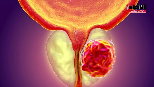 وزارة الأوقاف والشؤون الإسلامية نظمت حملة الكويت للتوعية من سرطان البروستاتا «عند الخميسن» تحت رعاية وزير الصحة د.أحمد العوضي بالتعاون مع الحملة الوطنية للتوعية بمرض السرطان «كان» والرابطة الكويتية لجراحة المسالك البولية