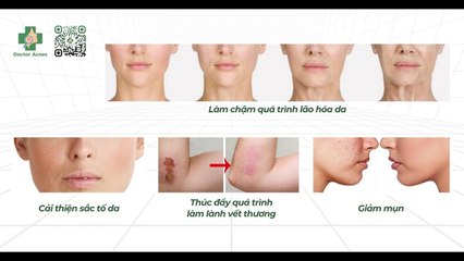 Tại sao dùng sữa rửa mặt lại nổi mụn?