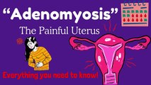 Adenomyosis 