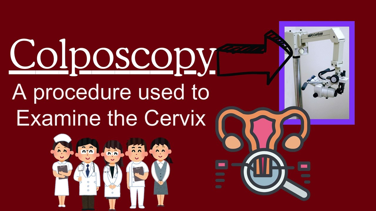 What is Colposcopy? Explained for cervical screening and Cervical Biopsy FOR Cancers and HPVs