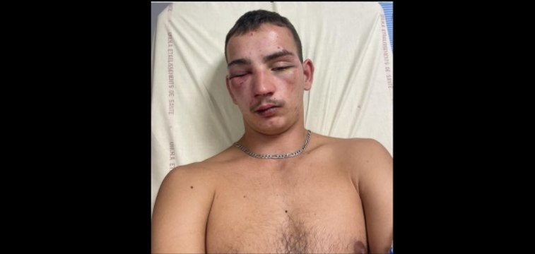 Le témoignage de Mathéo, 19 ans, frappé à coups de pieds dans la tête à la sortie d'une boîte à Dijon pour lui voler son portable : J'ai perdu connaissance. Heureusement, le cerveau n'a pas été touché