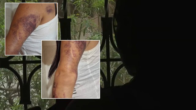 Mujer denunció ser víctima de agresiones y amenazas por parte de su expareja