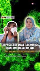 Ngeri, Ini yang Terjadi Jika Tuberkulosis Serang Tulang!