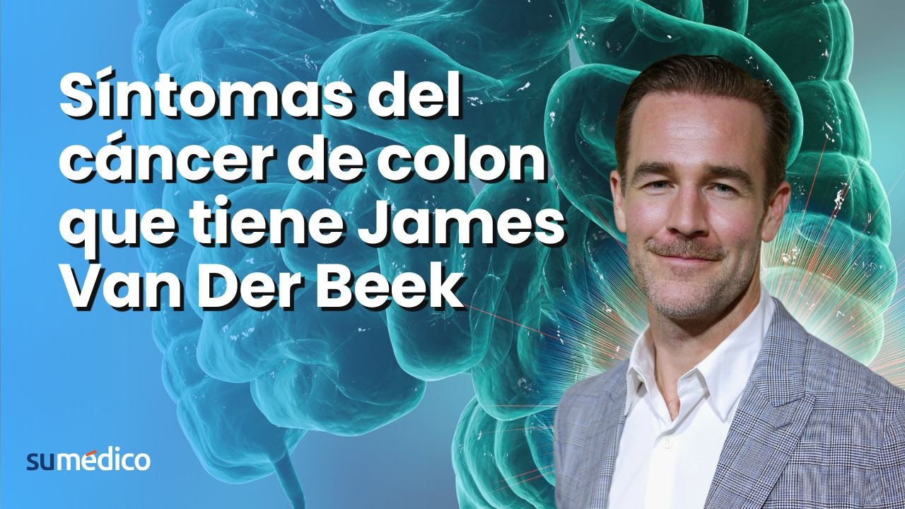Síntomas del cáncer de colon que tiene James Van Der Beek, de Dawson’s Creek