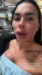 El impresionante cambio de una influencer tras hacerse una ‘armonización facial’ en el rostro 