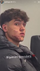 Así ha quedado la cara de Cubarsí tras la tremenda patada