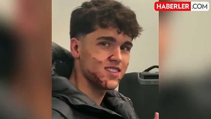 Barcelona'nın yıldızının suratını dağıttılar: Tam 10 dikiş atıldı