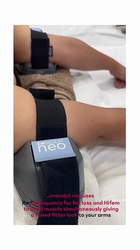 Toned arms with EMSCULPT Neo ! Build your tricep or bicep muscles or both with Neo and reach your fitness goals faster !#emsculptneo #neochandigarh #gymsofchandigarh #subzerofit #crossfit #bodyzonechandi