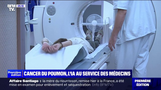 Cancer du poumon: comment l'IA pourrait aider les médecins à mieux déchiffrer les scanners