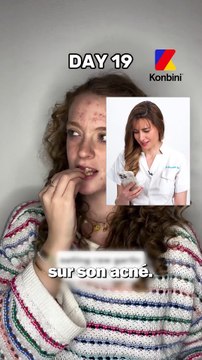 Manger de l'ail cru pour enlever son acné : Dermato Drey, dermatologue, revient sur cette nouvelle tendance farfelue