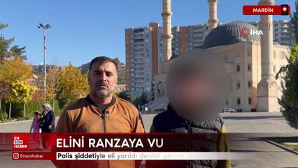 Mardin'de polis şiddetiyle eli yarıldı denildi, gerçek ortaya çıktı
